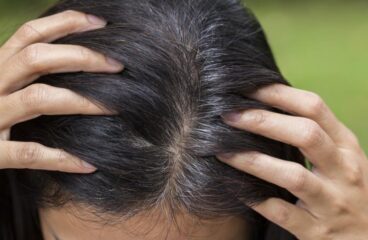 Що робити якщо волосся сивіє і випадає: кілька простих порад, для відновлення волосся